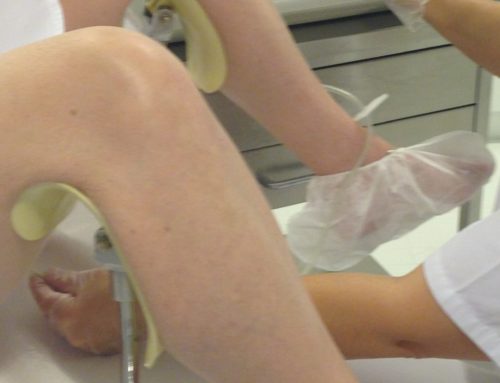 Ozonoterapia intravaginal como tratamiento de las vulvovaginitis de repetición.