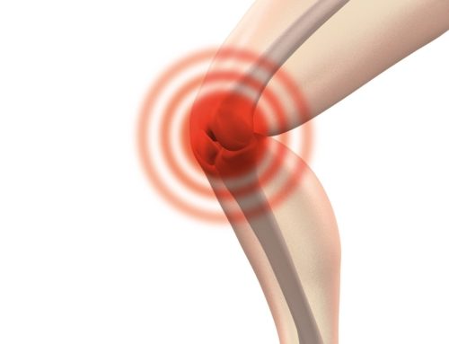 Dolor de Rodilla y Ozonoterapia Intrarticular